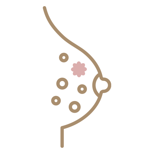 乳がん